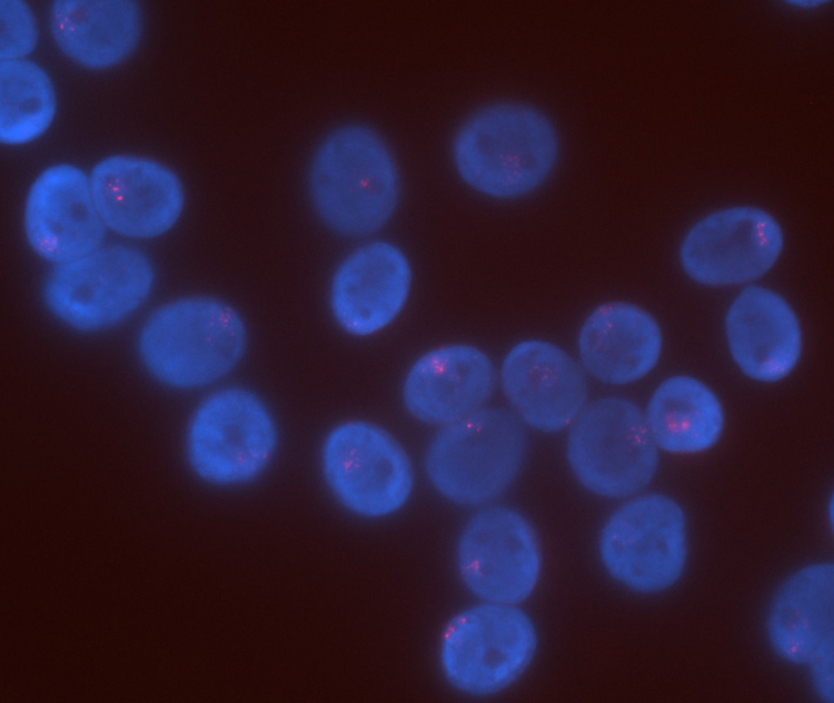 caption: AT2 cells, a lung cell that produces surfactant and gives rise to gas-exchanging cells, can be infected by SARS-CoV-2. Sex differences in gene expression of AT2 cells may help explain why older males have more severe outcomes from COVID-19 and similar diseases. Image courtesy of the Anguera Laboratory.