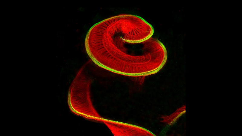 caption: Newborn rat cochlea with sensory hair cells and spiral ganglion neurons by Michael Perney.