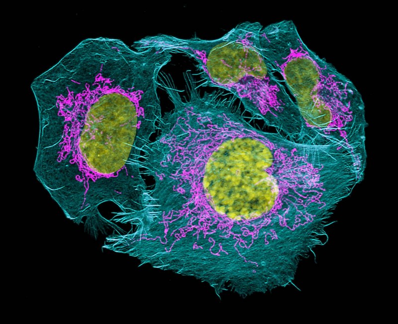 caption: Prostate cancer cells from Wistar Institute’s president & CEO Dario Altieri’s lab taken on the confocal. Jamie Hayden, managing director of Wistar’s Imaging Facility, received “Image of  Distinction” for this and an image of mouse skin collagen from Ashani Weeraratna’s lab.